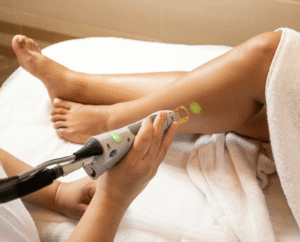 laser hair removal in a professional setting